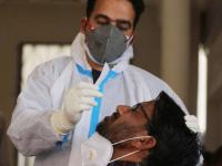 Omicron Variant: ओमायक्रॉन: घरात एखाद्यास कोरोनाची लागण झाल्यास काय करावं? जाणून घ्या सोप्या शब्दात... - Marathi News | Omicron Variant What to do if someone in family infected with corona here are all you need to do | Latest health Photos at Lokmat.com