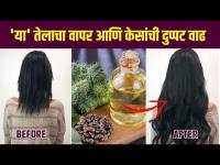 केसगळती थांबवण्यासाठी आणि केसांच्या वाढीसाठी उपाय |How Do You use Castor oil for Extreme Hair Growth