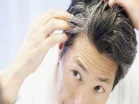 पांढरे केस नैसर्गिकरित्या काळे करण्यासाठी 15 घरगुती उपाय - Marathi News | 15 Household Remedies For Black Hair Naturally | Latest jarahatke Photos at Lokmat.com