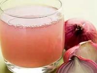 केस गळणं थांबून वाढतील दुपटीने! कांद्याचा रस घेऊन 'हा' शाम्पू तयार करा, केस होतील दाट - Marathi News | home made shampoo using onion juice for controlling hair fall, how to get rid of hair loss, home hacks to get rid of hair loss | Latest sakhi Photos at Lokmat.com