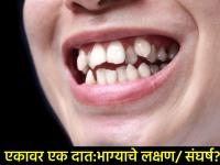 समुद्रिक शास्त्र: संघर्ष की राजयोग? 'दातावर दात' असणाऱ्या लोकांच्या नशिबाचा खेळ आणि त्यामागील सत्य - Marathi News | Samudrik Shastra: Conflict or Raja Yoga? The game of fate of people who are 'tooth for tooth' and the truth behind it | Latest bhakti Photos at Lokmat.com