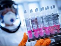 Corona Virus News: ऑक्सफर्डची लस 90 टक्के पास; तरीही संशोधक साशंक, जाणून घ्या कारण... - Marathi News | Oxford corona vaccine 90 percent pass; Still skeptical of researchers | Latest international Photos at Lokmat.com