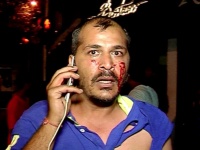 शिल्पा शेट्टीचे फोटो काढणा-या फोटोग्राफर्सना बाऊंन्सर्सनी रक्त येईपर्यंत मारले, गुन्हा दाखल