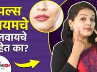 पिंपल्स पासून झटपट सुटका कशी मिळवायची | How to Remove Pimples Naturally | Home Remedies For Pimples