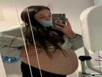 सर्व समजत होते हिला ९ महिन्यांची गर्भवती पण डॉक्टरने जे सांगितले ते ऐकुन सर्व झाले हैराण - Marathi News | woman was looking 9 months pregnant but it was cyst bigger than football | Latest jarahatke Photos at Lokmat.com