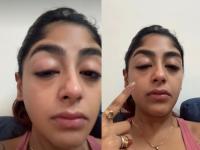 दात तुटला, डोळाही सुजला..., इन्फ्लुएन्सरच्या मित्राकडून अभिनेत्रीला मारहाण, नक्की काय घडलं? - Marathi News | splitsvilla 16 fame preet singh assaulted beaten by so called influencer s friend in night club in mumbai | Latest filmy News at Lokmat.com