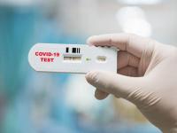 चिंताजनक! कोरोना व्हायरसची झाली होती लागण, पण 'इतक्या' लोकांमध्ये आढळल्याच नाहीत काही अ‍ॅंटीबॉडीज! - Marathi News | Coronavirus patients antibodies not detected | Latest health Photos at Lokmat.com