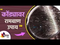 केसातील कोंडा घालवण्यासाठी रामबाण उपाय | How to Get Rid of Dandruff DIY Permanently | Lokmat Sakhi