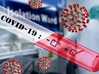 coronavirus : काय आहे रॅपिड अ‍ॅंटीबॉडी टेस्ट आणि कशी केली जाते? जाणून घ्या याचा काय होणार फायदा.... - Marathi News | coronavirus : What is rapid antibody test and how it's work? api | Latest health Photos at Lokmat.com