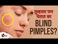 तुम्हाला पण येतात का Blind Pimples ? What's Blind Pimple? Home Remedy | Lokmat Sakhi