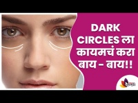 Dark Circles कायमस्वरूपी घालवायची सोपी पद्धत कोणती? Get Rid Of Dark Circles | Overnight Glowing Face