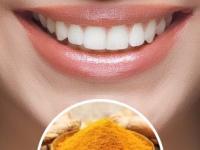 चमकदार दात हवेत तर ‘या’ ४ पदार्थांनी घासा, टूथपेस्टपेक्षाही भन्नाट उपाय-दातांची घ्या काळजी... - Marathi News | how to whiten teeth naturally home remedies for yellow teeth remove yellow stains from teeth natural teeth whitening at home Ayurvedic Tips To Remove Teeth Yellowing | Latest sakhi Photos at Lokmat.com