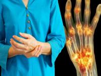 तुमच्या हाडांमधून आवाज येतो का? 'या' आजाराचा असू शकतो संकेत..... - Marathi News | Arthritis symptoms your bones creak sound could be the warning sign of osteoarthritis | Latest health Photos at Lokmat.com
