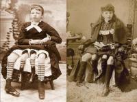 काय सांगता! दोन नाही तर चार पाय होते या महिलेला, तिच्या जन्माचं रहस्य आहे फारच रोमांचक - Marathi News | Myrtle Corbin the four legged woman | Latest jarahatke Photos at Lokmat.com