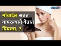 मोबाईल सतत वापरल्याने पिंपल्स येतात का? Mobile Phone Affects Skin | Causes Pimples | Lokmat Oxygen - Marathi News | Does constant use of mobile cause pimples? Mobile Phone Affects Skin | Causes Pimples I Lokmat Oxygen | Latest oxygen Videos at Lokmat.com
