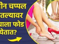 वेदनादायी शू बाईटवर करा हे घरगुती उपाय | How to Get Rid of Shoe Bite | Shoe Bite Remedy |