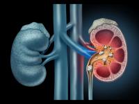 World’s largest and heaviest kidney stone removed from Sri Lankan man - News | World’s largest and heaviest kidney stone removed from Sri Lankan man | Latest health Photos at Lokmattimes.com