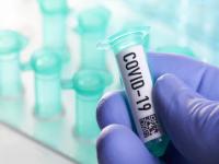 Coronavirus: कोरोना उपचारांवर शंका बळावली; ‘Ivermectin’ औषधावरील सर्वात मोठा स्टडी रिपोर्ट चुकीचा ठरला - Marathi News | Coronavirus: Huge study supporting ivermectin as Covid treatment withdrawn over ethical concerns | Latest international Photos at Lokmat.com