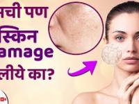 Damage Skin साठी करा हा घरगुती उपाय | How to Repair Damaged Skin | Damaged Skin Barrier