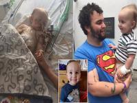 चिमुकल्याने चॉकलेट समजून गिळली घडाळ्याची बॅटरी, कराव्या लागल्या तब्बल २८ शस्त्रक्रिया...! - Marathi News | Child swallowed battery thinking chocolate, 28 surgeries had to be done ...! | Latest social-viral Photos at Lokmat.com