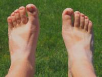 उन्हामुळे पाय काळसर झालेत ? नक्की करा हे घरगुती उपाय - Marathi News | Home remedies for sun tan | Latest beauty Photos at Lokmat.com