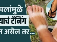पायांवर चपलांमुळे टॅनिंग झालं आहे का | How to Remove Tan From Legs at Home | How to Remove Sun tan