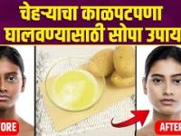 काळवंडलेल्या चेहऱ्यावर करा हा उपाय |How to Remove Sun Tan Naturally | Sun Tan Removal Home Remedies