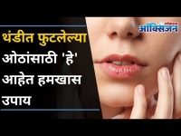 थंडीत फुटलेल्या ओठांसाठी घरगुती उपाय | 5 Ways to Treat Chapped Lips | Home Remedies | Lokmat Oxygen