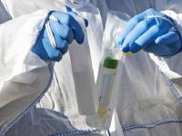 काळजी वाढली! कोरोनाशी लढण्यासाठी प्रभावी ठरणाऱ्या एंटीबॉडीबाबत तज्ज्ञांचा चिंताजनक दावा - Marathi News | CoronaVirus News : coronavirus antibodies herd immunity study | Latest health Photos at Lokmat.com