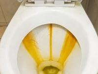 घरातल्या टॉयलेट सीटवर काळे- पिवळे डाग पडले? चमचाभर कॉफी पावडर करेल कमाल- खसाखसा न घासताही टॉयलेट सीट चमकेल - Marathi News | How to clean toilet seat stains naturally at home Best home remedy to remove black and yellow toilet stains Coffee powder hack for toilet cleaning | Latest sakhi Photos at Lokmat.com