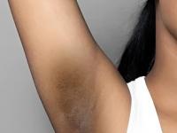 अंडरआर्म्सचा काळपटपणा होईल दूर, पांढऱ्या पदार्थाचा 'असा' करा उपयोग, ५ सोप्या पद्धती- दिसेल फरक - Marathi News | how to get rid black underarms how to use alum 5 benefits of turti skin care tips | Latest sakhi Photos at Lokmat.com