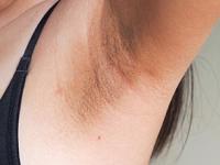 काखेत काळेपण-हाताचे कोपरे काळवंडले? १ चमचा मसूर डाळीचा ‘हा’ उपाय झटकन करतो टॅनिंग कमी - Marathi News | how to reduce blackness or tanning in underarms, home hacks to get rid of tanning on elbow | Latest sakhi Photos at Lokmat.com