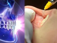 30 years later woman opened mouth : तब्बल ३० वर्षांनंतर महिलेनं उघडलं तोंड; या एका आजारामुळे फक्त द्रव पदार्थांवर होती जीवंत - Marathi News | Weird operation 30 years later the woman opened her mouth her face was filled with blood veins delhi | Latest health Photos at Lokmat.com