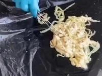 Man complains pain : महिना झाला पोटात दुखत होतं; शेवटी दवाखान्यात गेला; अन् डॉक्टरांनी प्रायव्हेट पार्टमधून काढला ५९ फूटांचा किडा - Marathi News | Man complains pain 59 foot tapeworm removed in thailand | Latest jarahatke Photos at Lokmat.com