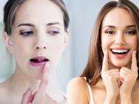 ओठ फाटल्यामुळे लूक बिघडतोय? तर ओठांची काळजी घेण्यासाठी वापरा 'हे' उपाय - Marathi News | How take care of lips in easiest way | Latest beauty Photos at Lokmat.com