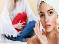 मासिक पाळीत आलेल्या पिंपल्समुळे त्वचेचं नुकसान होतं? मग 'या' टिप्सने प्रत्येक महिन्याचं टेंशन घालवा - Marathi News | How to remove pimples of periods by using home remedies myb | Latest beauty Photos at Lokmat.com