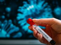 Coronavirus: धक्कादायक! तुम्हालाही असू शकते कोरोनाची लागण; ‘फॉल्स निगेटिव्ह’ रुग्णांनी वाढवली चिंता - Marathi News | Coronavirus:You may also have corona infections; 'False negative' patients raise concerns pnm | Latest international Photos at Lokmat.com