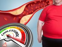 घरी बसून शरीरातील कॉलेस्ट्रॉल वाढलंय का? 'या' लक्षणांनी ओळखा - Marathi News | Amount of cholesterol in the body is increasing then identify this way myb | Latest health Photos at Lokmat.com
