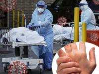 चिंता वाढली! समोर आली कोरोना विषाणूंची नवी लक्षणं, दुर्लक्ष केल्यास संक्रमणाचा धोका - Marathi News | CoronaVirus : New symptoms bone pain and tingling sensation cause covid 19 myb | Latest health Photos at Lokmat.com