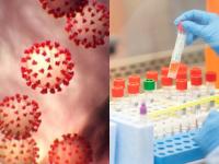 घाबरू नका! पुन्हा पॉझिटिव्ह येणाऱ्या कोरोना रुग्णांचं आता नो टेन्शन, अभ्यासात नवा खुलासा - Marathi News | covid patients testing positive after recovery are not infectious study shows vrd | Latest international Photos at Lokmat.com