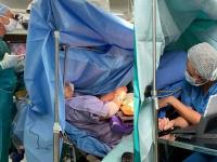 ऐकावे ते नवलंच! एकिकडे डॉक्टर करत होते सर्जरी; अन् रुग्ण महिला चक्क वडे तळत बसली... - Marathi News | Woman making traditional dish olive aperitifs during its open brain surgery | Latest jarahatke Photos at Lokmat.com