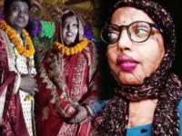 सात जन्माचं नातं: १७ व्या वर्षी झाला होता अॅसिड हल्ला, आता मुलीनं केला आपल्या बॉयफ्रेन्डशी विवाह - Marathi News | Relationship of seven births: Acid attack at the age of 17, now the girl is married to her boyfriend | Latest national Photos at Lokmat.com