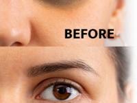 How to remove dark circles : डार्क सर्कल्समुळे चेहरा थकल्यासारखा, वयस्कर वाटतोय? टवटवीत, ग्लोईंग त्वचेसाठी हे घ्या उपाय - Marathi News | How to remove dark circles : Remove dark circles under eyes with these 10 easy home remedies | Latest sakhi Photos at Lokmat.com