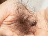 How to stop hair fall immediately : केस फार गळतात, तेल शॅम्पू बदलूनही उपयोग होत नाही? फक्त १ उपाय महिनाभरात देईल दाट केस - Marathi News | How to stop hair fall immediately at home : Hair fall control tips guava leaves for hair know 4 ways to use it | Latest sakhi Photos at Lokmat.com