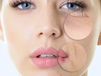 Mango Benefits For Skin : रिसर्च-रोज आंबे खाल्ल्यानं कमी होतील म्हतारपणाच्या खुणा; पण किती प्रमाणात खायचा? जाणून घ्या - Marathi News | Mango Benefits For Skin : According to study eating this much of mango can lessen signs of ageing and reduce wrinkle | Latest sakhi Photos at Lokmat.com