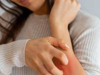 संध्याकाळ होताच घरात खूप डास येतात? ५ उपाय, डासांचा उच्छाद होईल पटकन कमी - Marathi News | Natural Mosquito Repellent Solutions : Mosquito home remedies and how to make mosquito repellent at home | Latest sakhi Photos at Lokmat.com