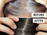 फक्त १० रुपये खर्च करा आणि पांढरे केस काळे करण्याची युक्ती वापरा, ४ उपाय कायम दिसाल तरुण - Marathi News | Grey Hair Solution at Home : White hair grey hair home remedy for white beard | Latest sakhi Photos at Lokmat.com