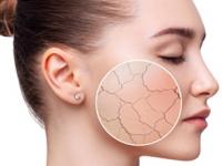 महागडे मॉईश्चरायझर लावूनही त्वचेचा ड्रायनेस कमी होत नाही? वापरा फक्त ३ पदार्थ, त्वचा होईल सुंदर- चमकदार - Marathi News | How to reduce dryness of skin without using moisturiser? Winter care tips for dry skin, Just 3 ingredients that reduces dryness and makes your skin glowing | Latest sakhi Photos at Lokmat.com