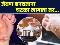 जेवण बनवताना भाजल्यावर काय कराल? | How To Treat Burns At Home | Home Remedies for Burns | AI2