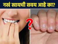 नखं खायची सवय ठरू शकते घातक? | How to Stop Biting your Nails | Nail Biting Habit | Lokmat Sakhi AI2